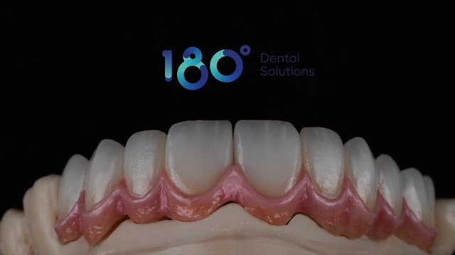 Restauration sur implants
